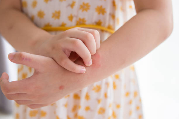 Child's arm with rashes